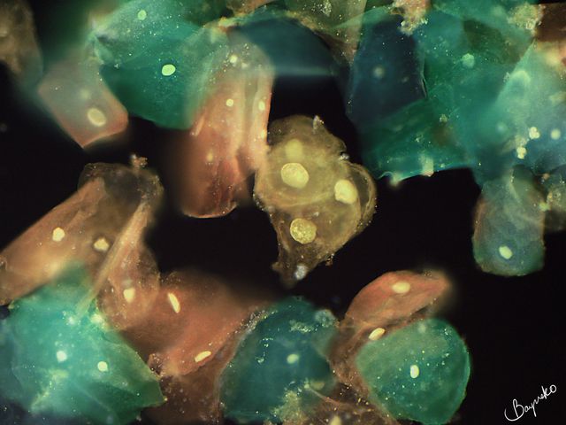 Squamous