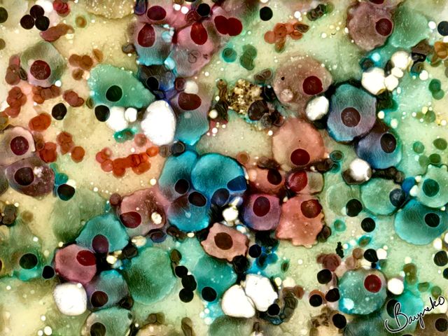 Oncocytes